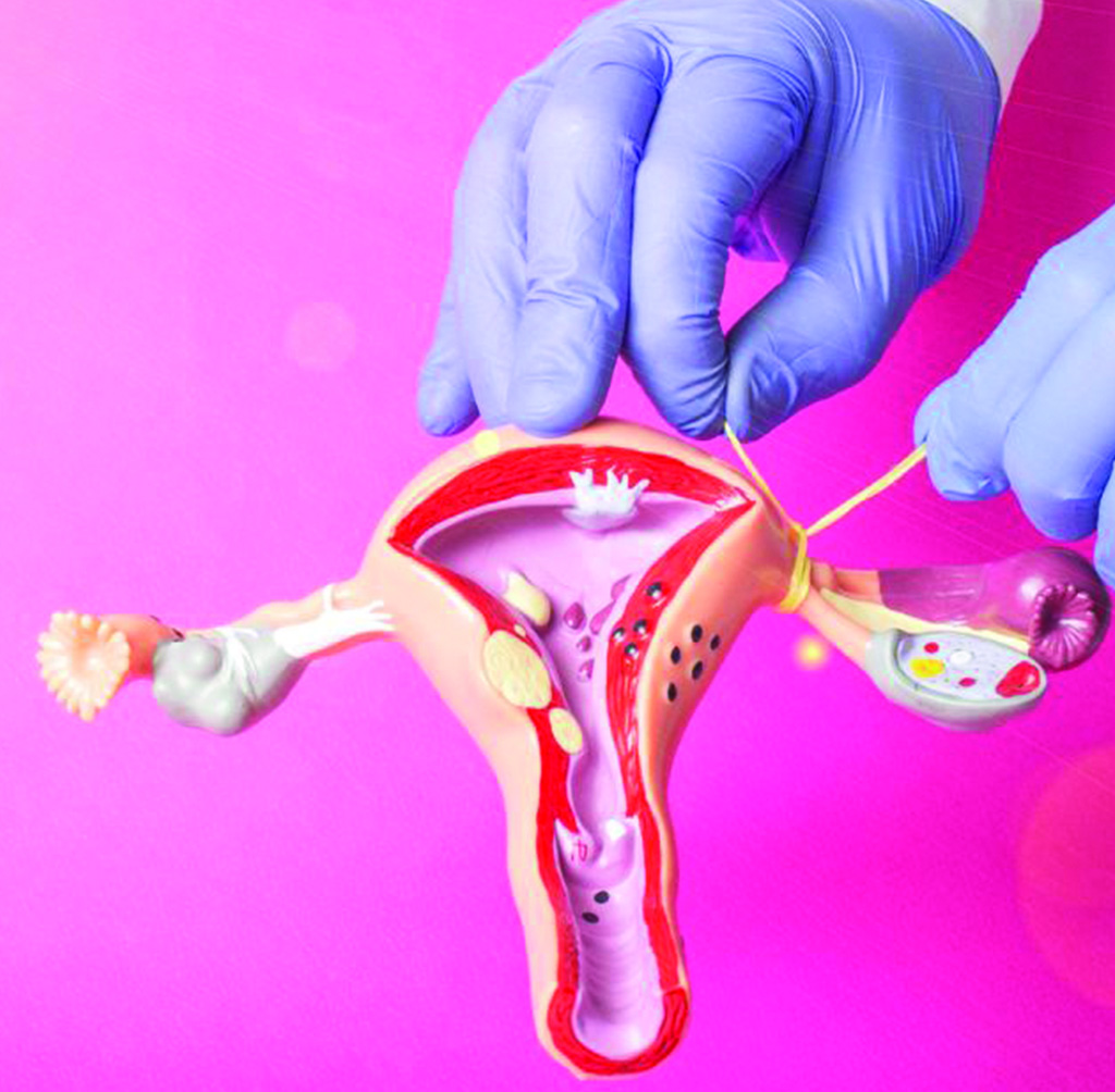 Best hospital for gynecology in Chennai